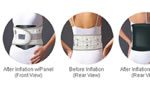 Lumbar Traction DDS500